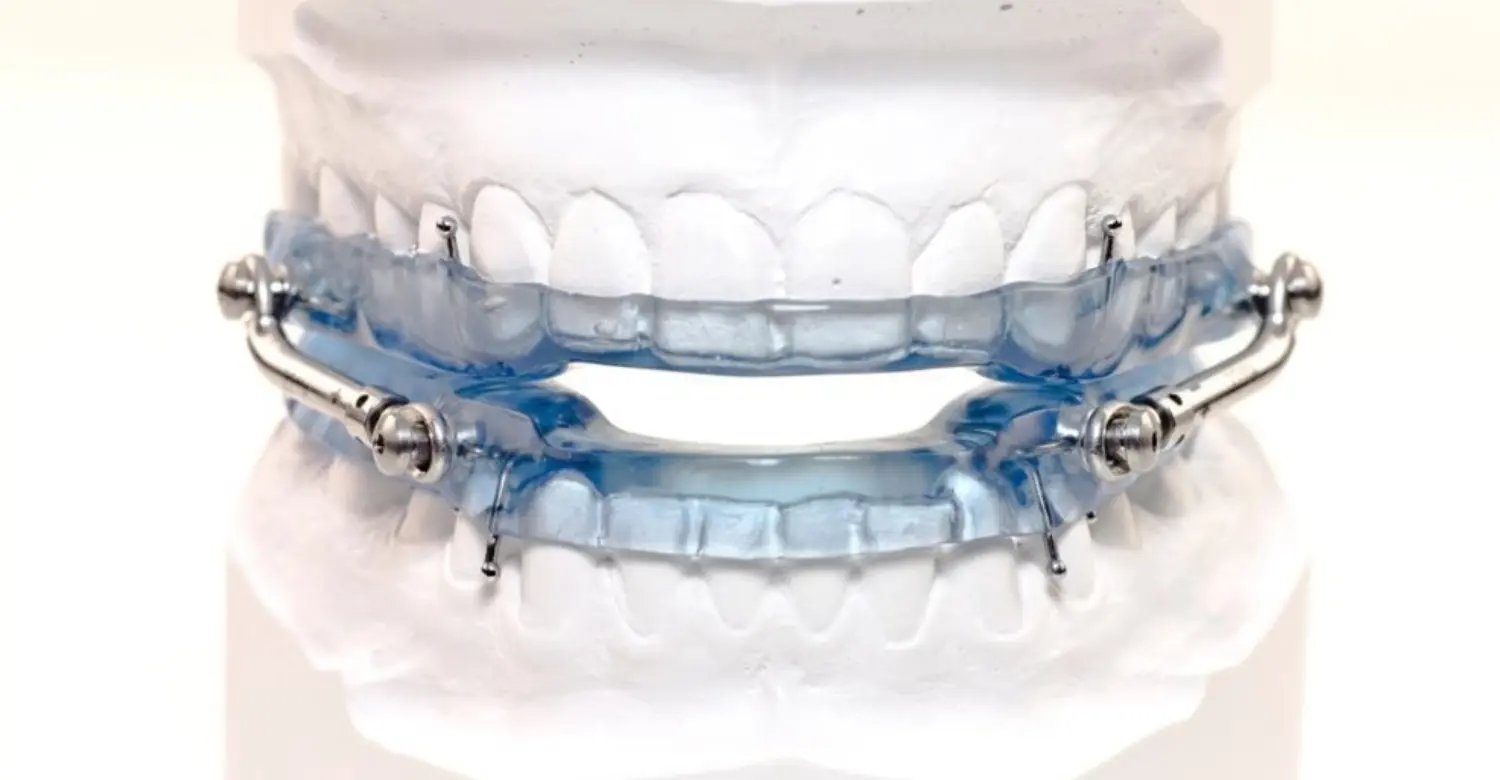 Oral Appliance for Sleep Apnea 2